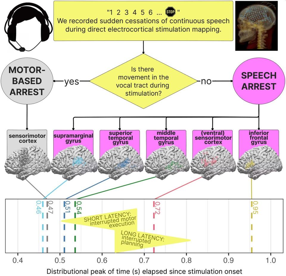 Infografía sobre la medición y análisis de la latencia en diferentes partes del cerebro | Heather Kabakoff et al. Brain Communications (2024). DOI: 10.1093/braincomms/fcae053