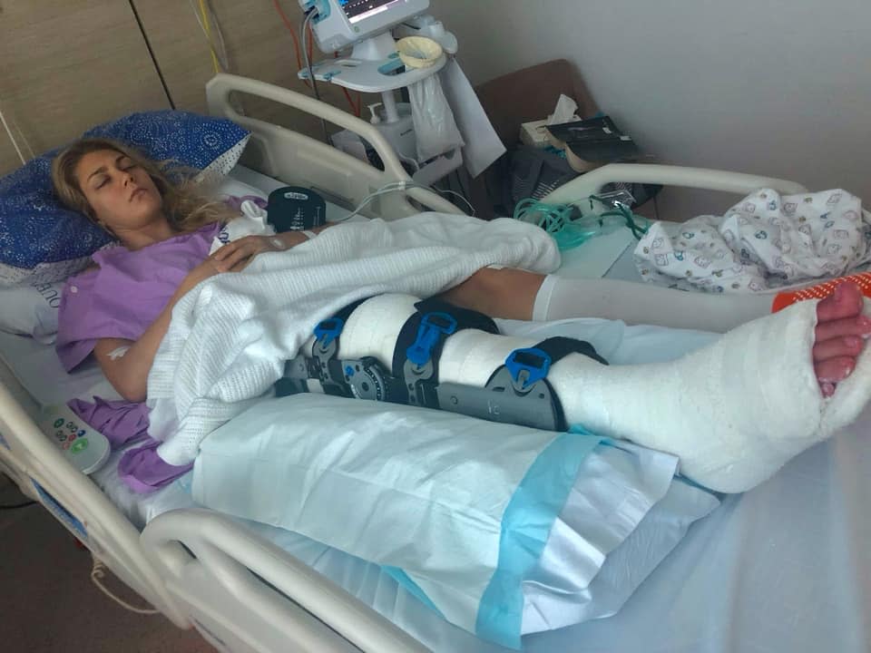 The 27-year-old required two surgeries to her injured knee and foot. Source: Facebook