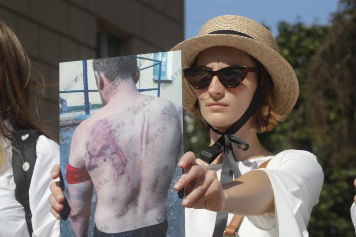 A woman holds a photo of a protester, beaten by police during a rally in Minsk, Belarus, Saturday, Aug. 15, 2020. Thousands of demonstrators have gathered at the spot in Belarus' capital where a protester died in clashes with police, calling for authoritarian President Alexander Lukashenko to resign. (AP Photo/Dmitri Lovetsky)