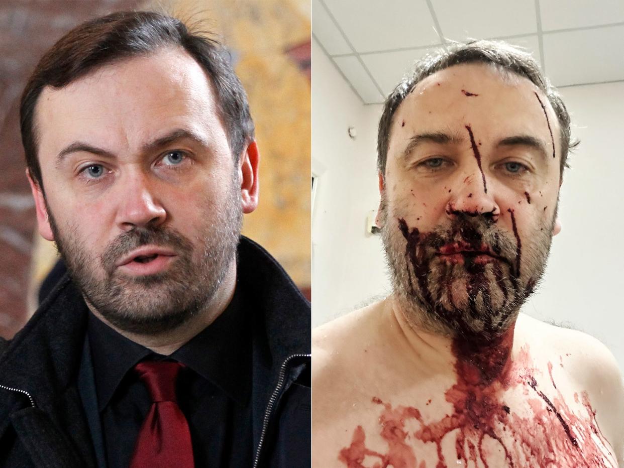 Side by side of Ilya Ponomarev unhurt (on left), hurt after protest (on right).