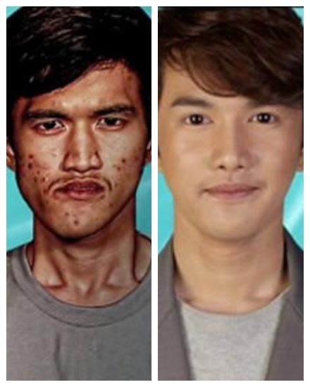 korean plastic surgery before and after gone wrong