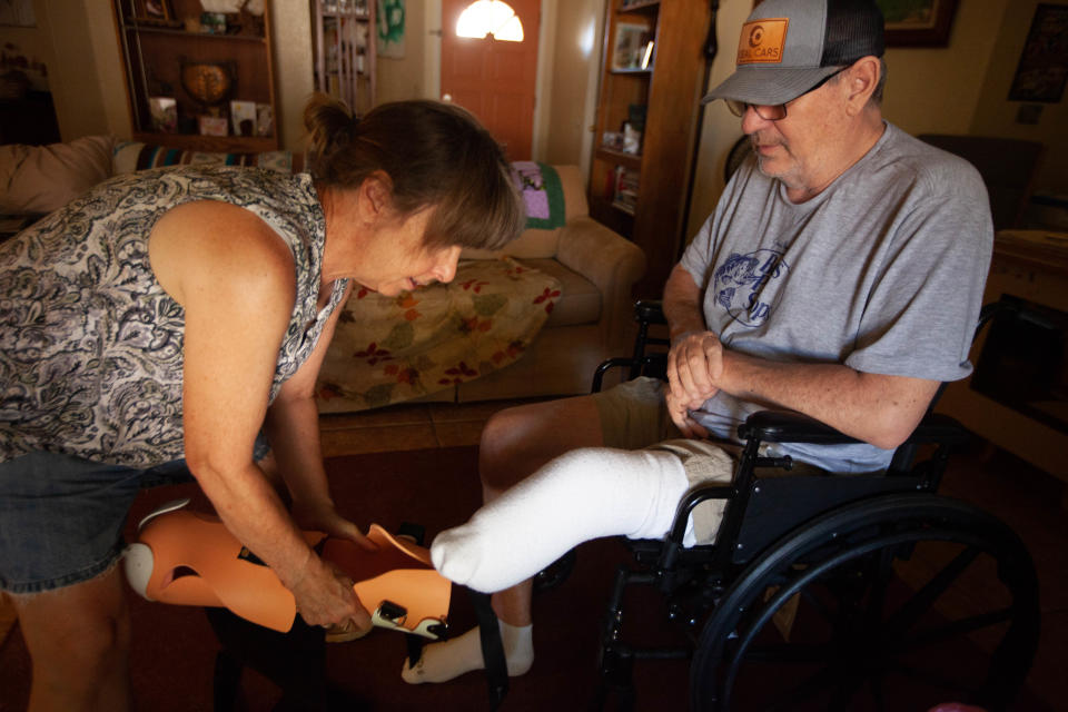 Mike Bonebrake lost a leg after a Modern Vascular procedure another surgeon says he didn't need.