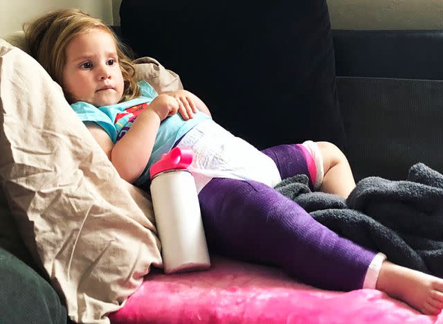 <p>Amelia Zamora</p> Zamora's daughter laying on the couch in her cast.