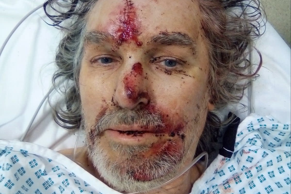 Howard Burns, 56, said he has faced a “living nightmare” after the accident in Walthamstow (handout)