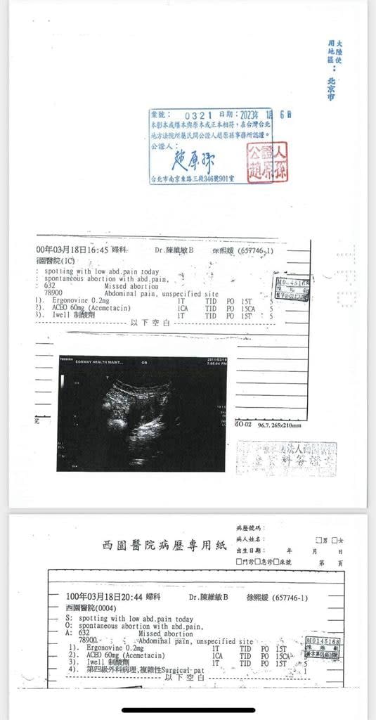 不只流產1次！大S證實與汪小菲婚禮前「胎死腹中」：我們真的很努力了