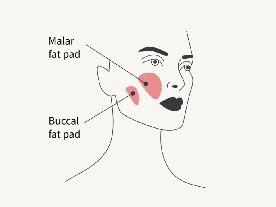 ‘Buccal fat removal doesn’t create definition, it just creates emptiness between the cheek and the jawline,’ said Dr Tiryaki (iStock)