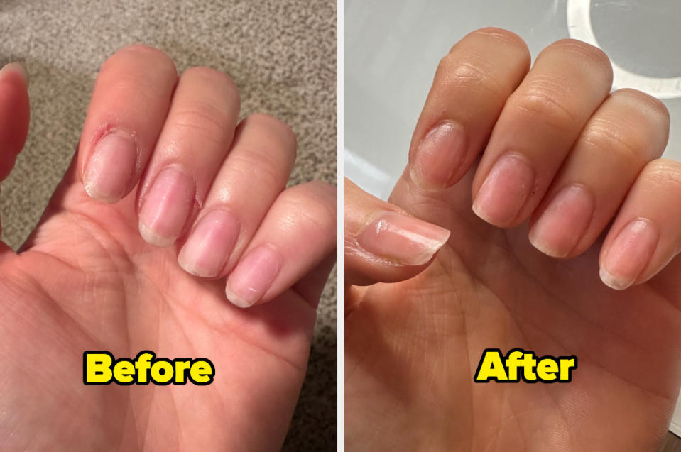 a side by side of the author's nails