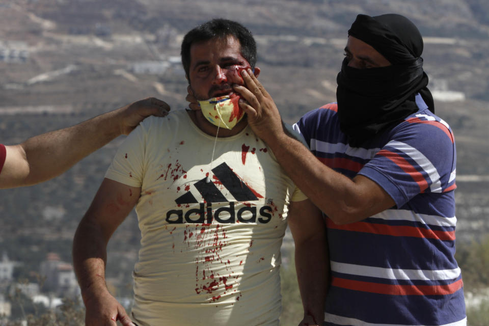 A injured Palestinian man is tended to by demonstrators during clashes as they protest against Israeli Jewish settlements in Asira al-Qibliya near the West Bank city of Nablus, Friday, Sept. 25, 2020. (AP Photo/Majdi Mohammed)