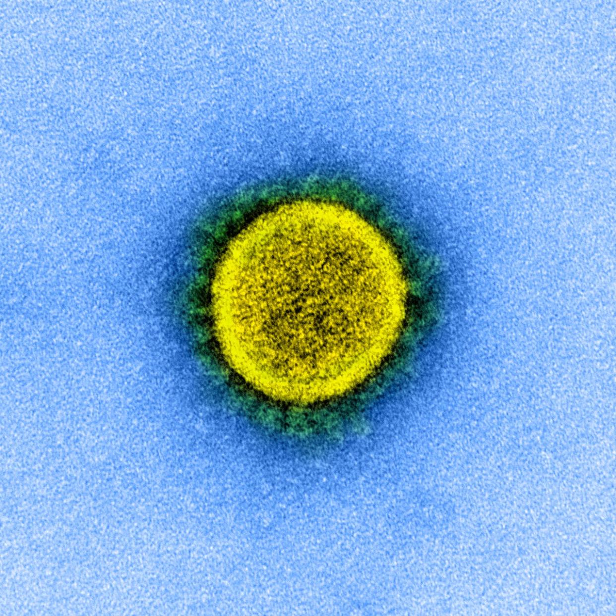 A transmission electron micrograph of SARS-CoV-2, isolated from a patient. (National Institute of Allergy and Infectious Diseases - image credit)