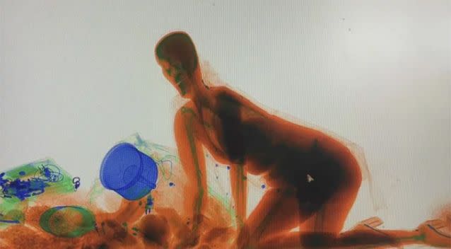 The woman appeared inside the X-ray machine. Source: PearVideo