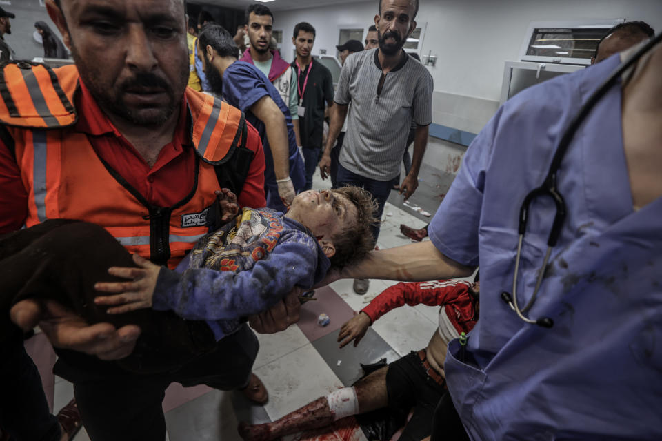 傷者當中包括大量小孩。 (Photo by Ali Jadallah/Anadolu via Getty Images)
