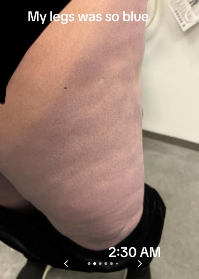 You Won't Believe The Unexpectedly Hilarious Reason Shein Leggings Landed  Someone In The ER - Yahoo Sports