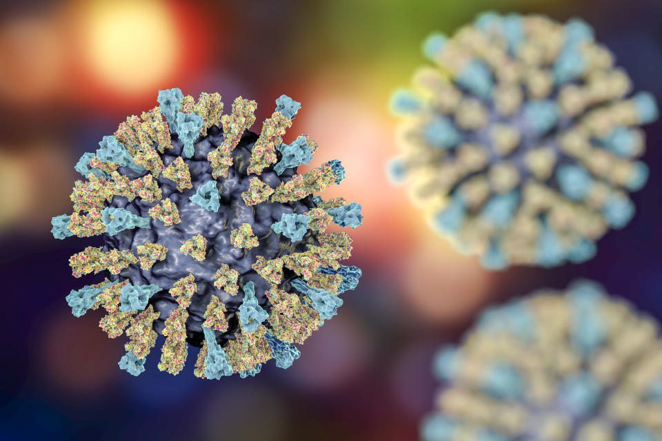 Measles cases are popping up in parts of Canada, amid a resurgence of the virus around the world. (Photo via Getty Images)