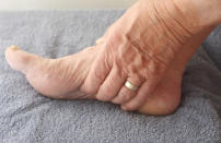 3. Red flag: Frequent foot cramping (charley horses). What it means: The sudden stab of a foot cramp -- basically, the hard contraction of a muscle -- can be triggered by fleeting circumstances such as exercise or dehydration. But if it happens often, your diet may lack sufficient calcium, potassium, or magnesium. Pregnant women in the third trimester are especially vulnerable thanks to increased blood volume and reduced circulation to the feet. More clues: Charley horses tend to rear up out of nowhere, often while you're just lying there. They can be a single sharp muscle spasm or come in waves. Either way, soreness can linger long afterward. What to do: Try to flex the foot and massage the painful area. You may also be able to relax the muscle by applying a cold pack or rubbing alcohol. To prevent cramps, stretch your feet before you go to bed. Then drink a glass of warm milk (for the calcium).