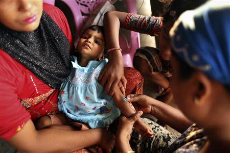 Musana Khatu, a 22-month-old Rohingya girl suffering from diarrhoea for 13 days, receives treatment after her mother brought her from the Baw Dupa camp for internally displaced people to a makeshift clinic at the Thet Kae Pyin camp in Sittwe, Rakhine state, April 23, 2014. REUTERS/Minzayar