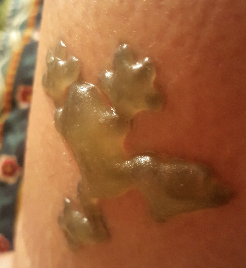 A close-up of a gummy bear melted onto a person's skin