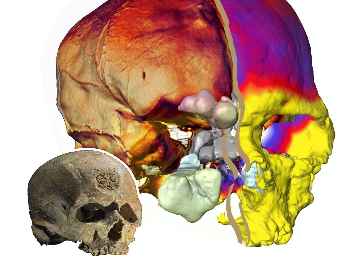 Le fossile original Cro-Magnon 1 et une image virtuelle montrant grâce à l'imagerie la moitié droite de l'endocrâne et la moitié gauche du crâne (le code couleur sur le crâne correspond à la variation d'épaisseur des os). Antoine Balzeau CNRS/MNHN, Fourni par l'auteur