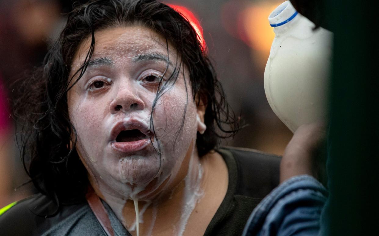 A protester uses milk to treat the sting of tear gas after police tried to disperse demonstrators in Minneapolis - Carlos Gonzalez/Star Tribune/AP