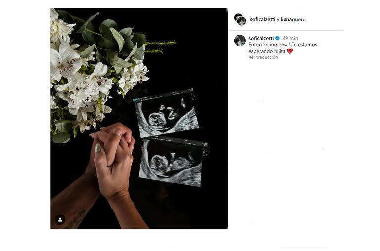 El posteo donde la pareja confirmó que espera una niña (Foto: Captura Instagram/@sofiacalzetti)