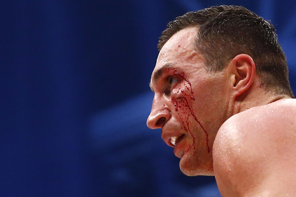 Boxing - Wladimir Klitschko v Tyson Fury WBA, IBF & WBO Heavyweight Title's - Esprit Arena, Dusseldorf, Germany - 28/11/15 Wladimir Klitschko with a cut to the face during the fight Reuters / Kai Pfaffenbach Livepic