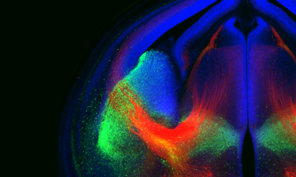 This colorful picture shows the wiring in a developing brain. Axons (red) are the cables that neurons use to transmit their information, often over relatively long distances and taking highly circuitous routes. The other colors represent different areas of the brain.