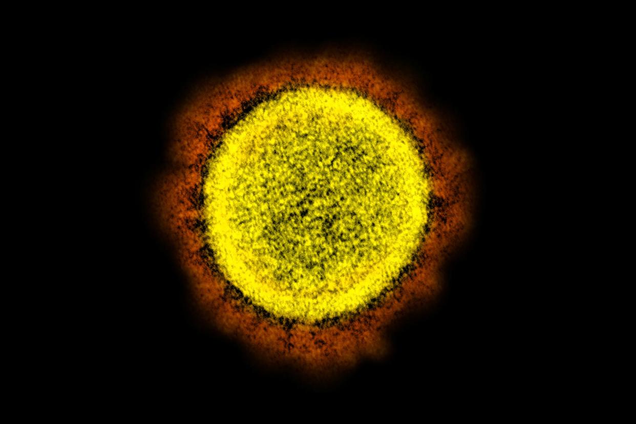 This electron microscope image made available by the National Institute of Allergy and Infectious Diseases shows a Novel Coronavirus SARS-CoV-2 particle isolated from a patient, in a laboratory in Fort Detrick, Md. (NIAID/NIH via AP, File)