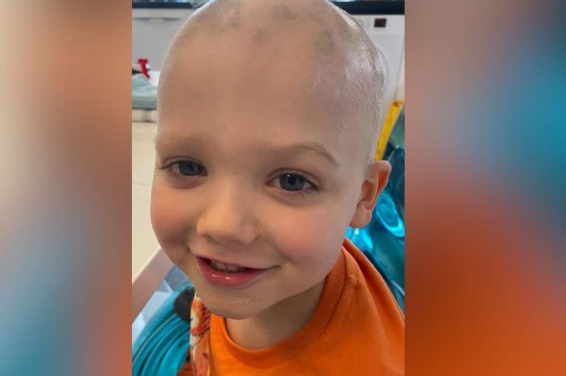 In October 2023, Ollie’s mum noticed a small patch of hair missing on her son’s head – since then, it has spread to the point where Ollie is now missing 80 per cent of his hair -Credit:Helen Smith