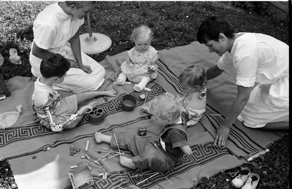 Children born with malformed limbs getting used to using prostheses, July 1962.(Stan Wayman/The LIFE Picture Collection via Getty Images)