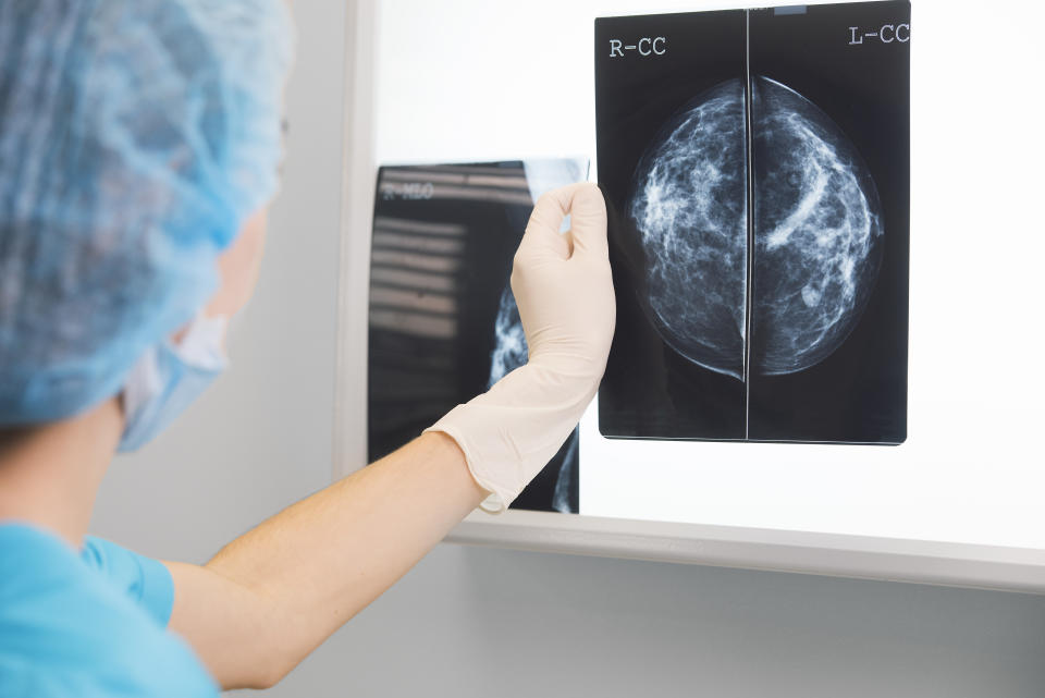450,000 women in the UK were not invited to final breast screenings between 2009 and 2018. Source: Getty Images
