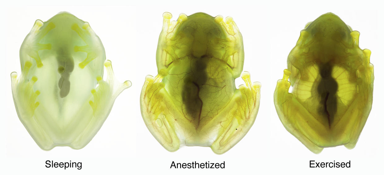 This combination of photos provided by researchers in December 2022 shows the same glass frog photographed during sleep, under anesthesia, and while active (in transmitted light), showing the difference in red blood cells within the circulatory system. Some frogs found in South and Central America have the rare ability to turn on and off their nearly transparent appearance, researchers report Thursday, Dec. 22, 2022, in the journal Science. (Jesse Delia/AMNH via AP)