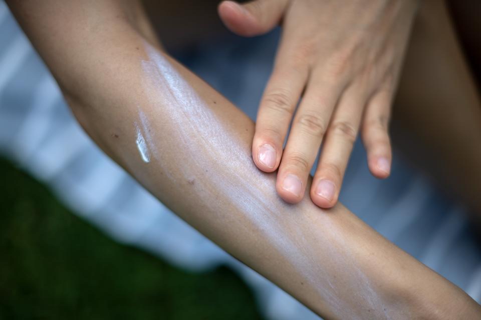 Physical (mineral) sunblocks leave a whiter cast on the skin than chemical sunblocks. (Photo: picture alliance via Getty Images)