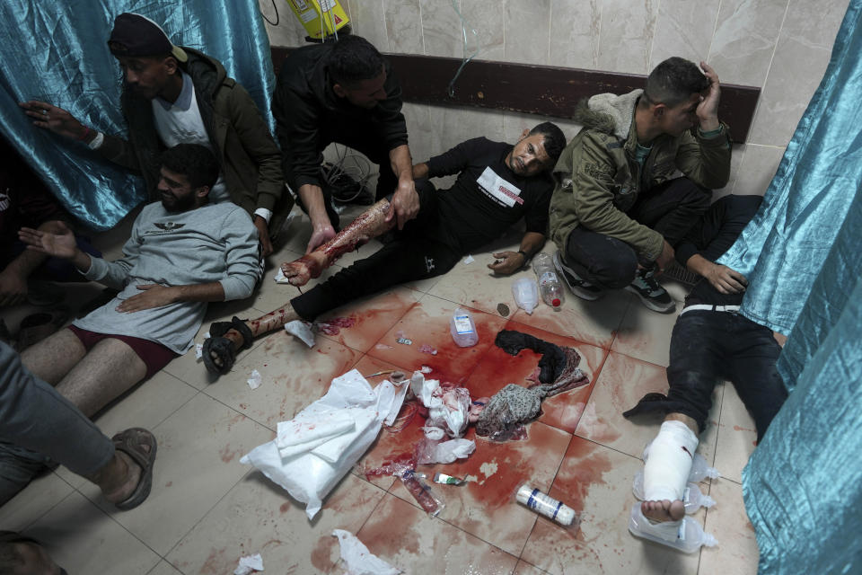 Palestinians wounded by the Israeli army as they tried to cross back to the northern Gaza Strip are treated in al Aqsa Hospital in Deir al Balah on Friday Nov. 24, 2023 as the temporary ceasefire took effect. (AP Photo/Adel Hana)