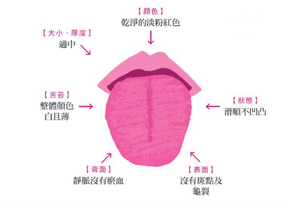 每天3秒鐘　6種舌相看出健康狀況