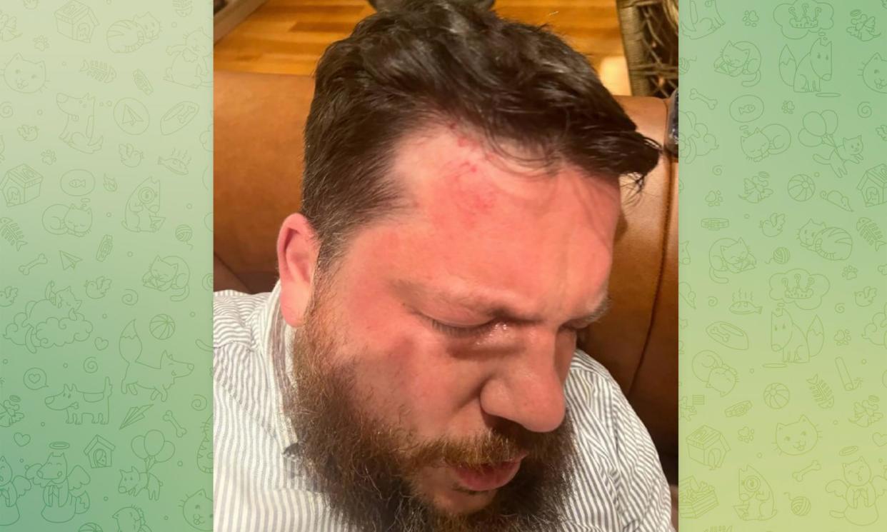 <span>Alexei Navalny’s team published pictures of the injuries sustained by Volkov, in a Telegram post.</span><span>Photograph: AP</span>
