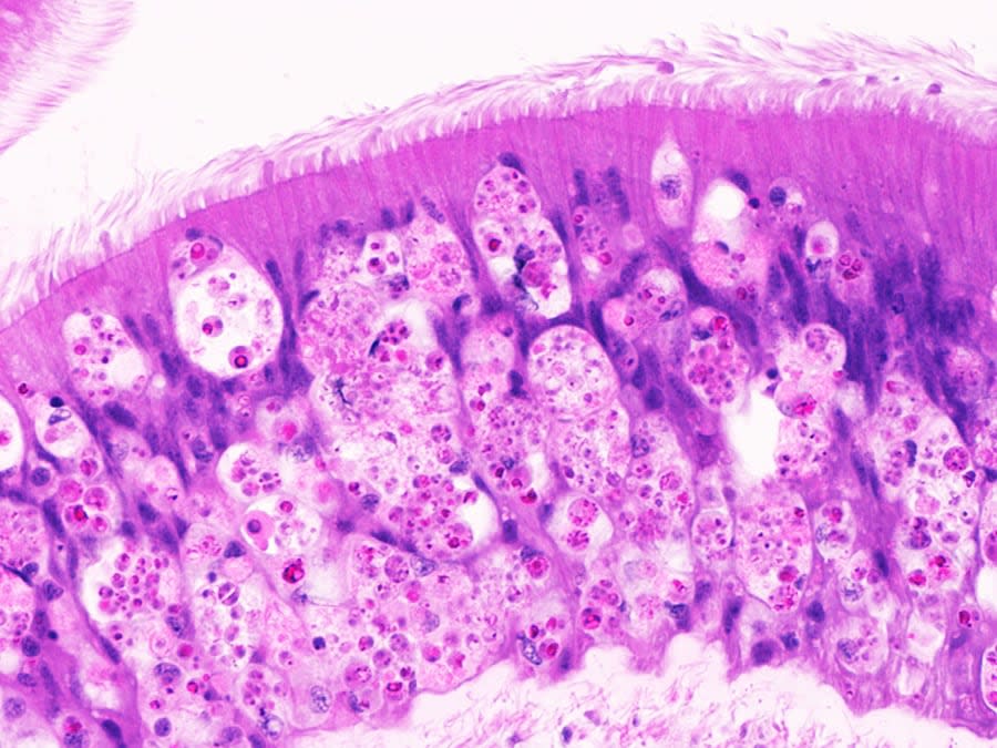 A microscopic image of an oyster stomach lining ravaged by tiny, spherical Perkinsus marinus cells. 