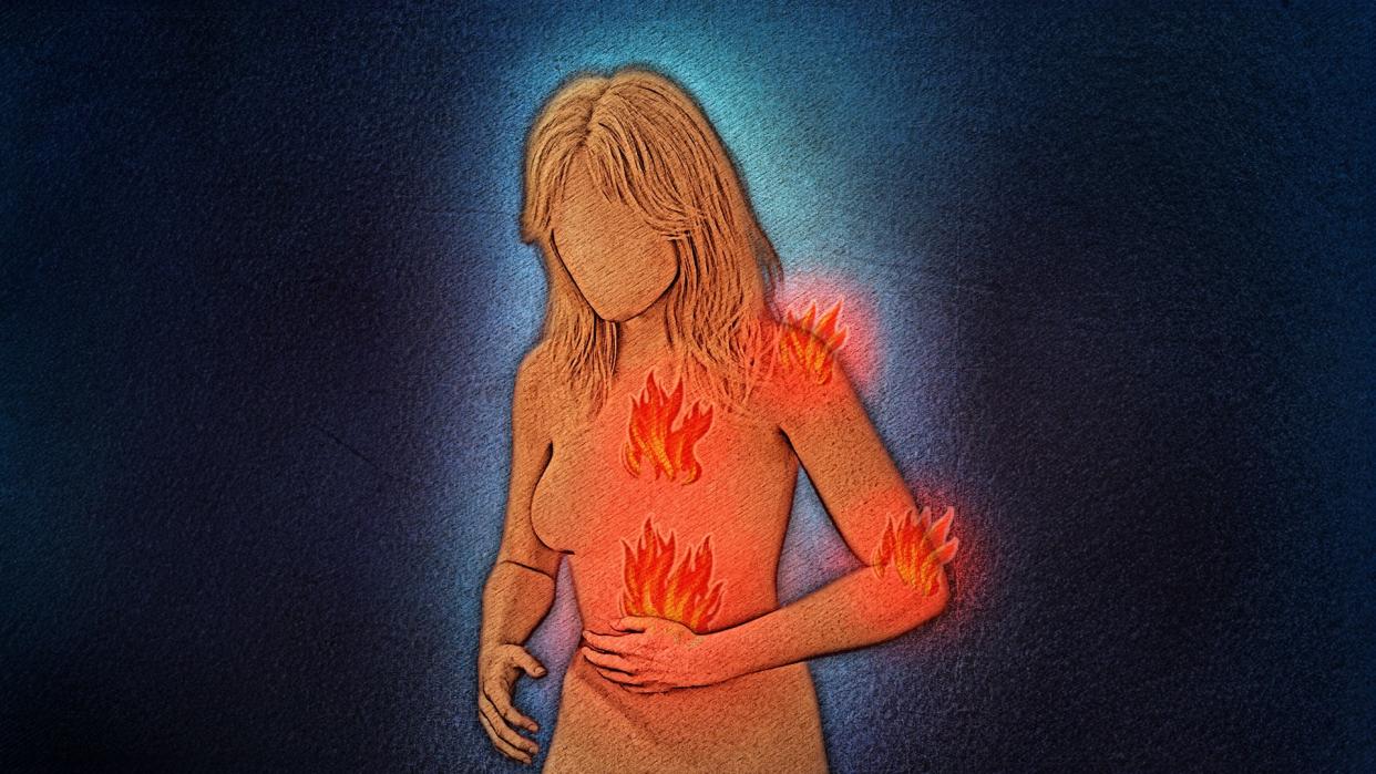  Artwork displaying the figure of a woman (in orange) with four flames coming from her body against a blue background. 