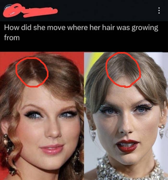 "How did she move where her hair was growing from?"