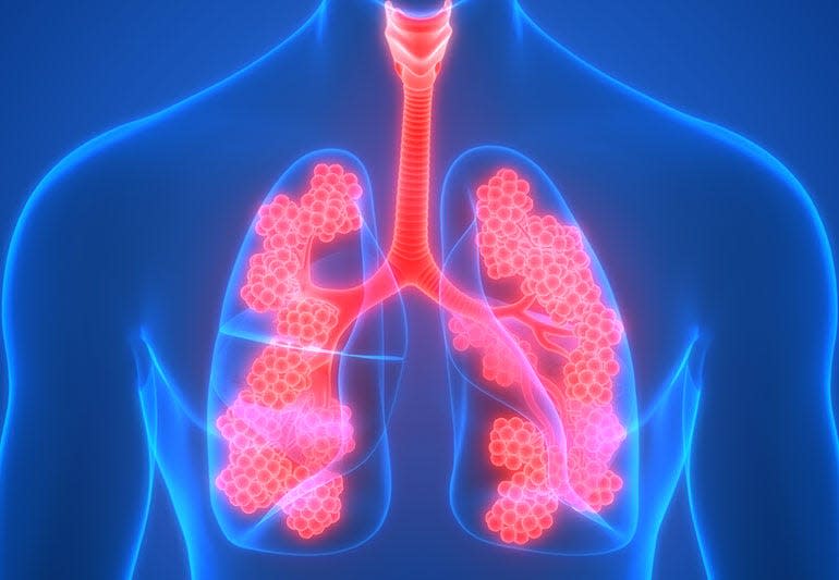 Traditionally COPD is treated with bronchodilator medications and oxygen, COPD and emphysema patients can still experience symptoms such as breathlessness, decreased lung function, and reduced exercise capacity – making daily activities difficult.