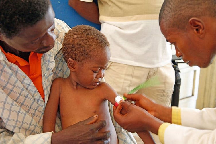 <span class="caption">Doctor measuring a child to see if they’re malnourished.</span> <span class="attribution"><a class="link " href="https://commons.wikimedia.org/wiki/File:Medical_staff_examine_a_child_for_signs_of_malnourishment_in_DRC_(7610291856).jpg" rel="nofollow noopener" target="_blank" data-ylk="slk:Russell Watkins/Department for International Development/ Wikimedia Commons;elm:context_link;itc:0;sec:content-canvas">Russell Watkins/Department for International Development/ Wikimedia Commons</a>, <a class="link " href="http://creativecommons.org/licenses/by/4.0/" rel="nofollow noopener" target="_blank" data-ylk="slk:CC BY;elm:context_link;itc:0;sec:content-canvas">CC BY</a></span>