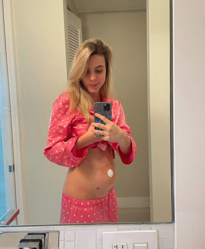 lele-pons-apendicitis