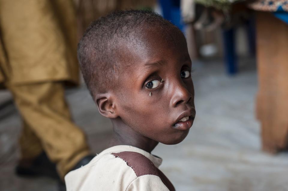 Extreme poverty and malnutrition in parts of Nigeria enable extremist militias such as Boko Haram to attract&nbsp;recruits and support. (Photo: STEFAN HEUNIS/AFP/Getty Images)