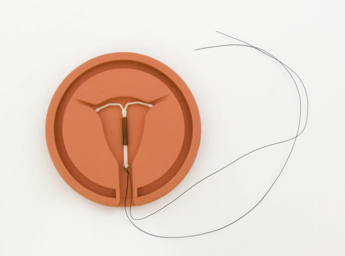 An inserted IUD