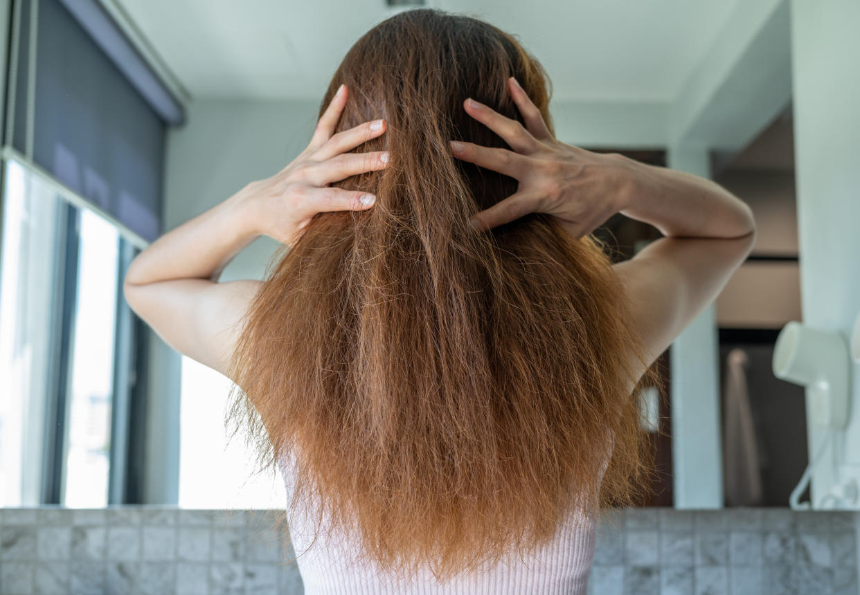 Brittle hair can be a sign of a vitamin deficiency. (Getty Images)
