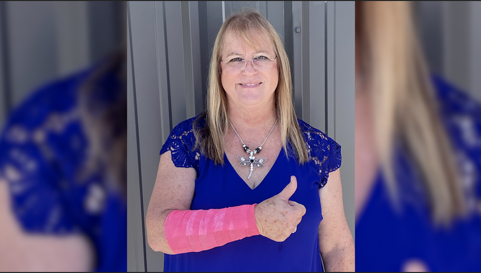 Peggy Jones says she was attacked by a snake and a hawk at the same time while doing lawn work in Silsbee, Texas last month.  / Credit: Peggy Jones