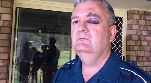 Mr Johnson was punched 60 times in the shocking incident. Photo: Supplied