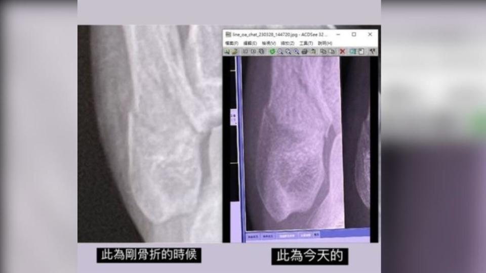 優格姐姐聽到要挖骨崩潰求救。（圖／翻攝自優格姐姐IG）