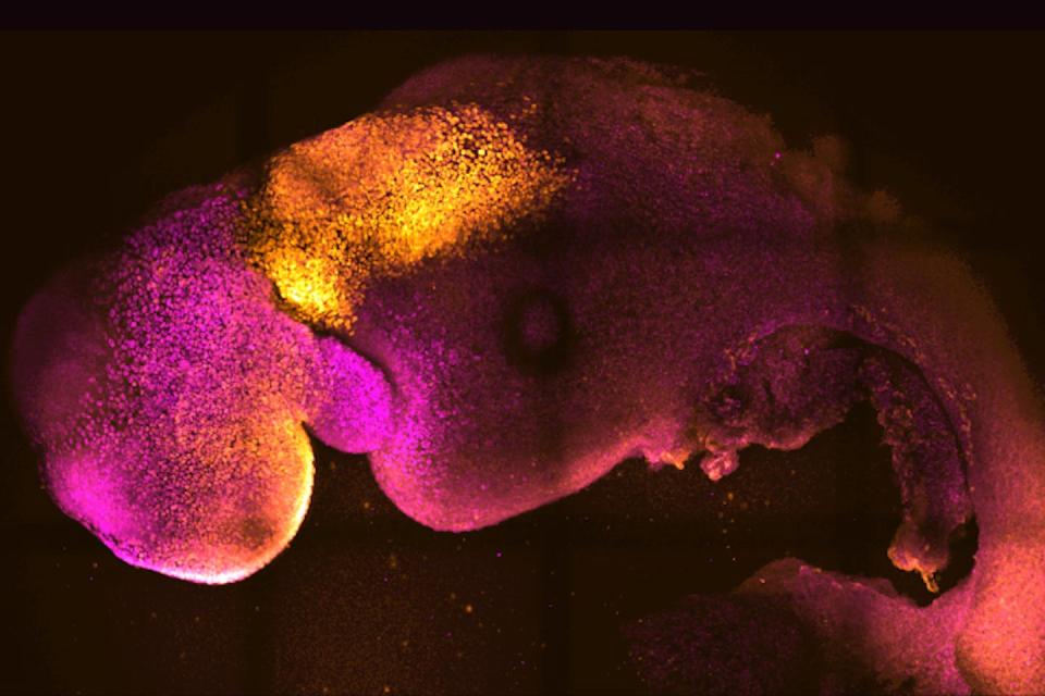 A microscopic image of a synthetic mouse embryo with colours added to show brain and heart formation. (Gianluca Amadei, Charlotte Handford via AP)