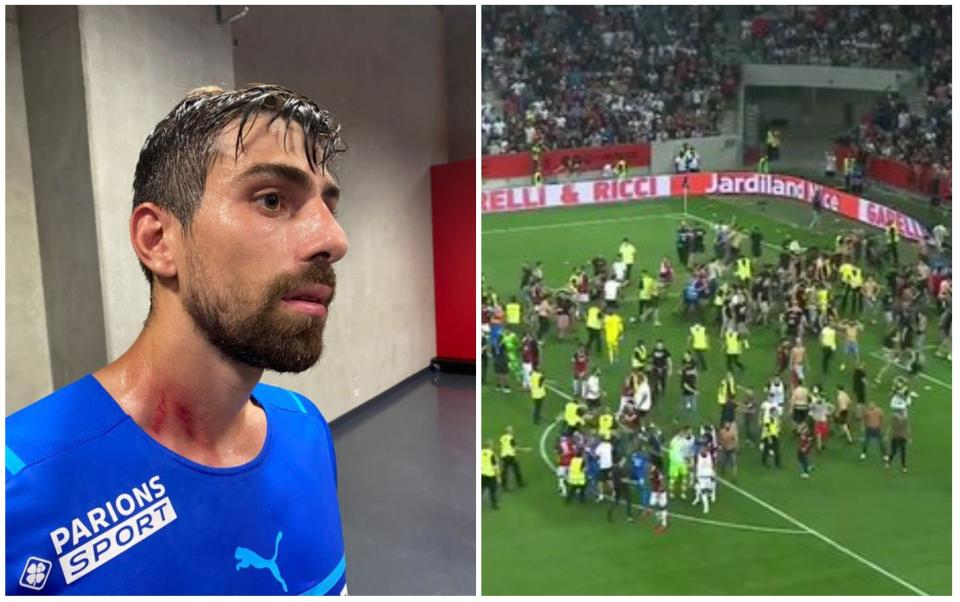 Las heridas en el cuello de Luan Peres y la batalla campal que se formó en el Niza - Olympique de Marsella tras la invasión de los ultras del equipo local. (Foto: Twitter / @RMCsport / Amazon Prime Video).