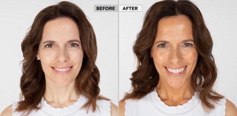 Before and after of model using this serum