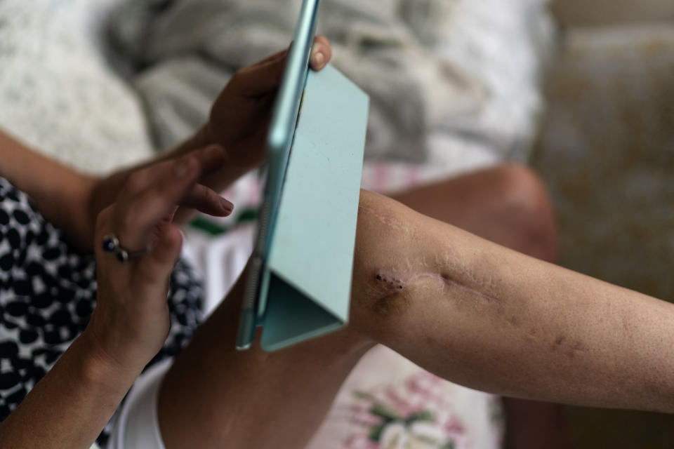 Janet Paulsen rests at her home in Acworth, Ga., Monday, Aug. 7, 2023. She still bears deep scars from the day her estranged husband ambushed her in their garage in 2015. (AP Photo/David Goldman)